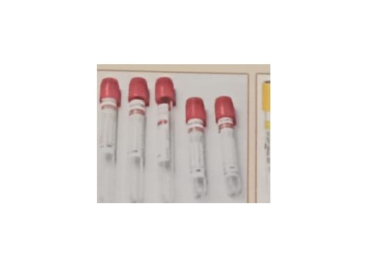 Clot and Plain Tubes