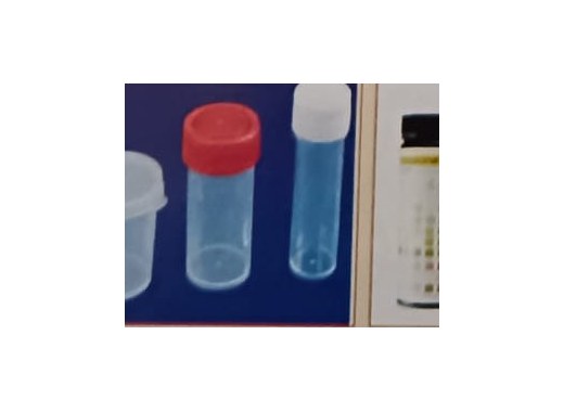 Urine Container